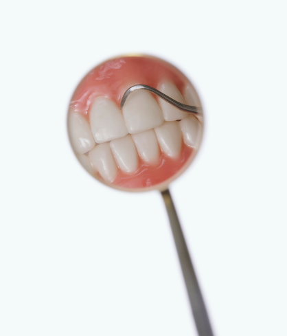 Fixed Teeth in 72 Hours