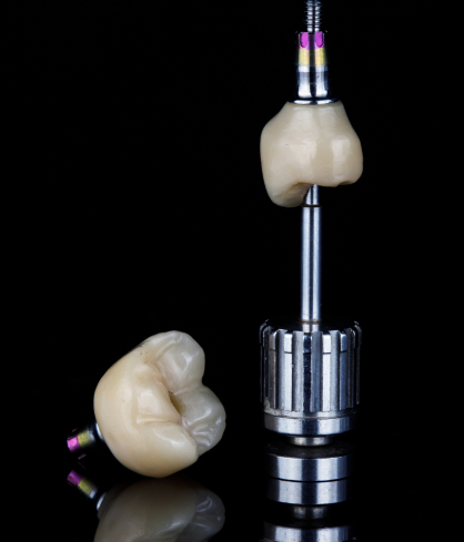 Dental Crowns & Bridges
