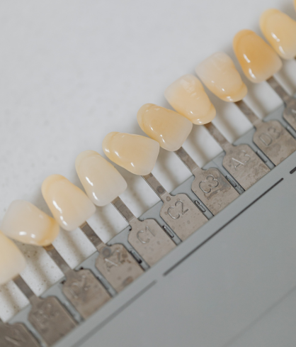 Dental Veneers & Laminates