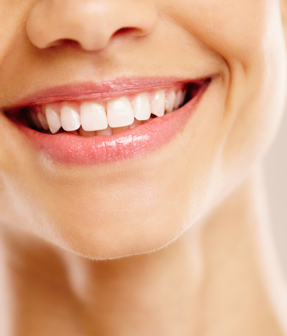 Smile Makeover