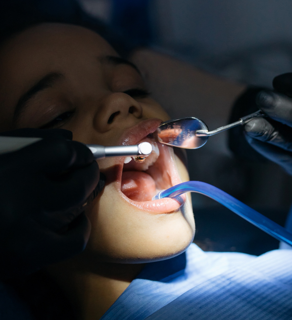 Fluoride Treatment for Stronger Teeth