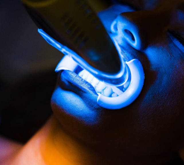 In-Clinic Teeth Whitening