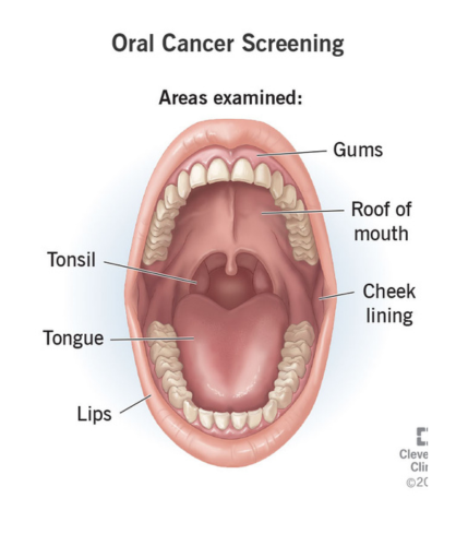 Oral Cancer Screening