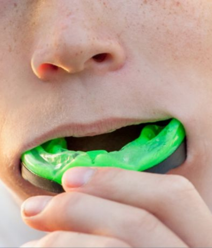 Sports Mouth Guard