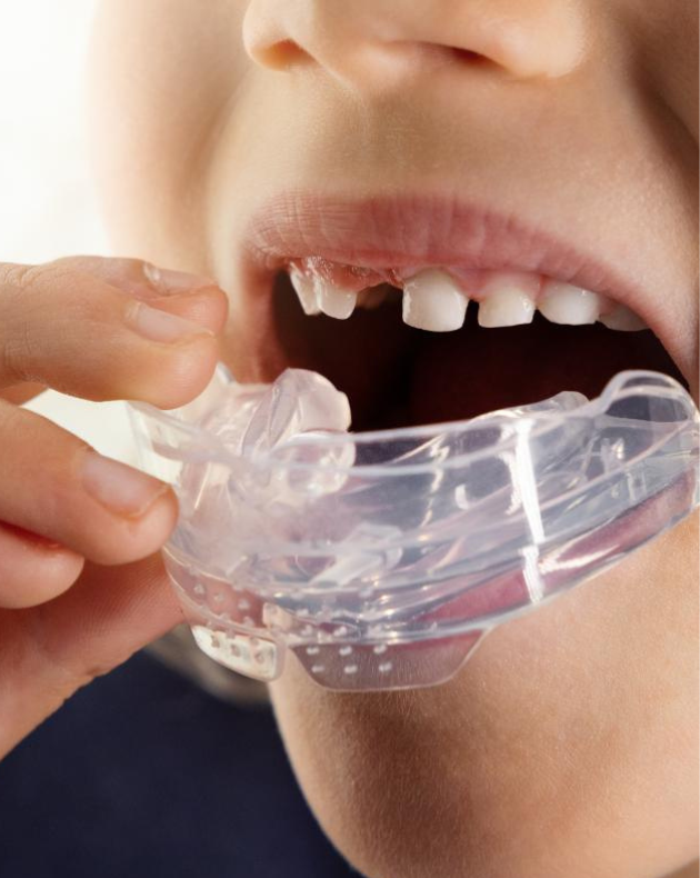 Sports Mouth Guard(2)