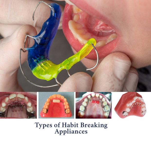 Types of Habit Breaking Appliances