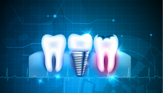 Digital-Dentistry